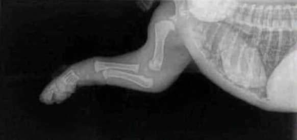 Radio patte arrière